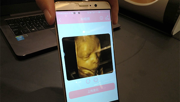 创业年代:全球首创胎儿相机,打开准爸妈新需求市场 创业年代:全球首创胎儿相机,打开准爸妈新需求市场-苍鲸创行